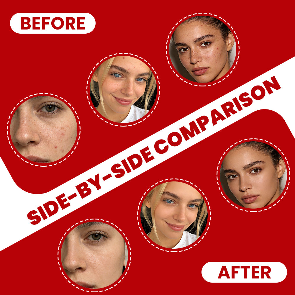 LMPH240 before and after side-by-side skin comparison graphic showing improved skin clarity and tone