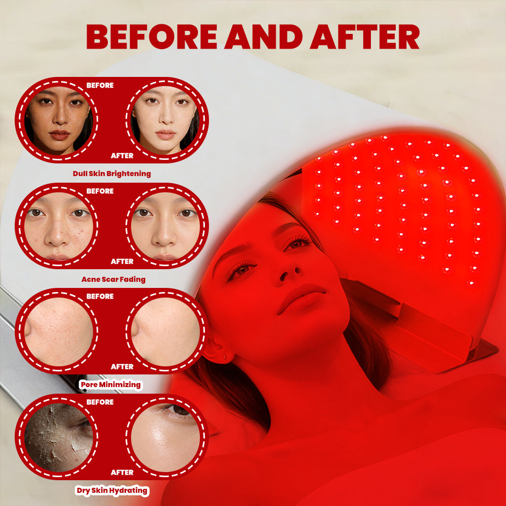 LMPH240 before and after results for dull skin brightening, acne scar fading, pore minimizing and dry skin hydrating, with woman wearing the red LED mask